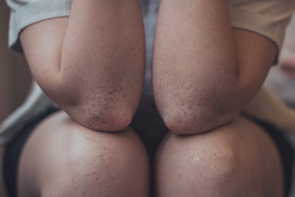 Why do my joints pop?